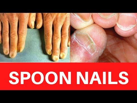 Starting Solids with Little Spoon - Medicine & Manicures %
