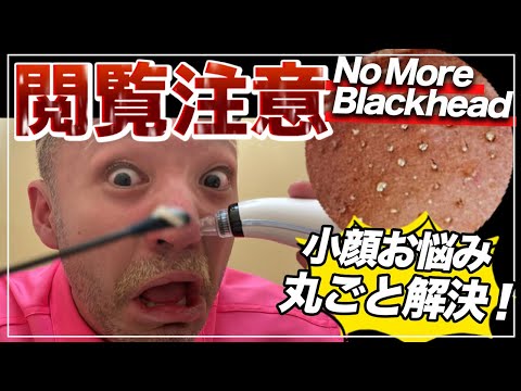 【閲覧注意】黒ずみをなくす方法！メイクアップアーティストが人気アイテムNO MORE BLACK HEADを正直レビュー最強毛穴スキンケアが想像以上⁈How To Remove Black Spots