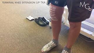 Improving knee extension post TKA during gait