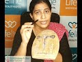 Causes of infertility dr sreelakshmy r nair gynecologist  fertility specialist lifeline hospital