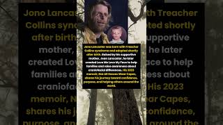 Jono Lancaster Turned A Rare Condition Into A Global Message Of Strength