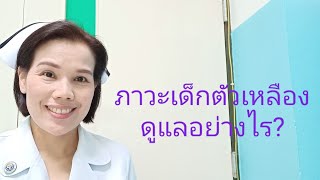 เด็กแรกเกิดมีภาวะตัวเหลืองดูแลอย่างไร?