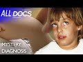 The Baby Who Changed Colours: Segawa's Dystonia | Medical Documentary | Reel Truth