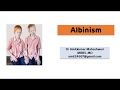 Albinism || Deficiency of Tyrosinase