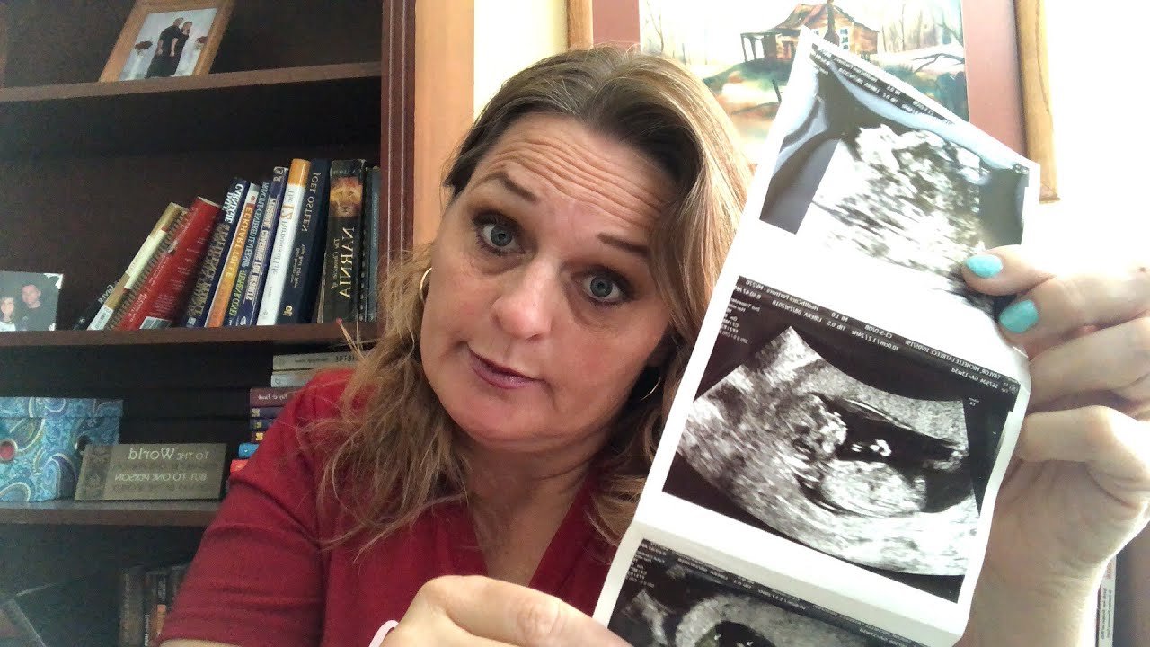 46 & PREGNANT w BABY #13/WEEK 15/ STRESS ME OUT....???!!!