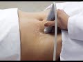US do Trato Gastrointestinal -  EaD