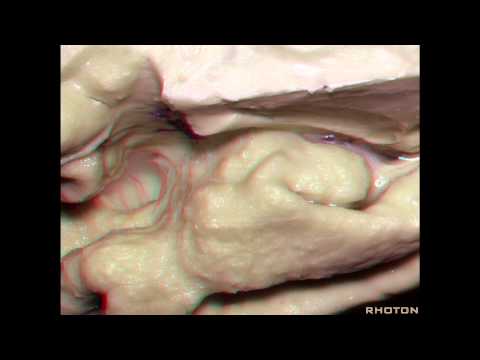 Navigating the Ventricles