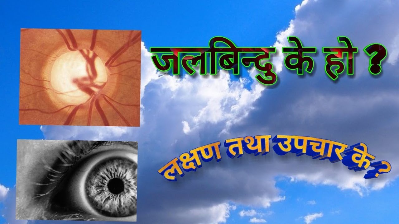 जलबिन्दु रोग के हो ? यसका लक्षण तथा उपचार के ? नेपाली हरुले एकपटक हेर्नै पर्ने भिडियो (Glaucoma)