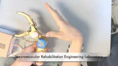 EMG-driven musculoskeletal model-based prosthesis control
