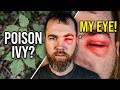 Poison Ivy Destroyed My Face | Here's Why