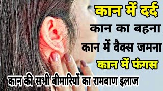 कान के सभी प्रकार के रोगों को दूर करने का घरेलू रामबाण इलाज । Kan me dard ka ilaj Kan me dard Remedy