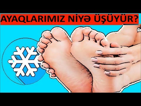 Video: Ayaq biləyinizi burub -açmadığınızı necə bilmək olar (şəkillərlə)