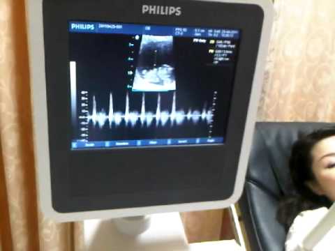 VID-20110425-寶寶8週6天了