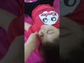 ضمور مخيخ مرض متطور ضمور مخيخ مرض متطور