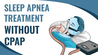 Sleep Apnea Treatment without CPAP