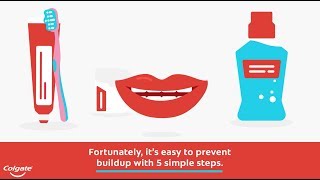 How To Remove And Prevent Plaque On Teeth Colgate