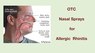 OTC Nasal Sprays for  allergic rhinitis