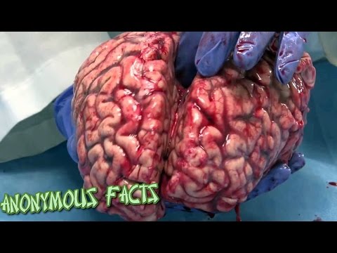 საინტერესო ფაქტები ჩვენი ტვინის შესახებ