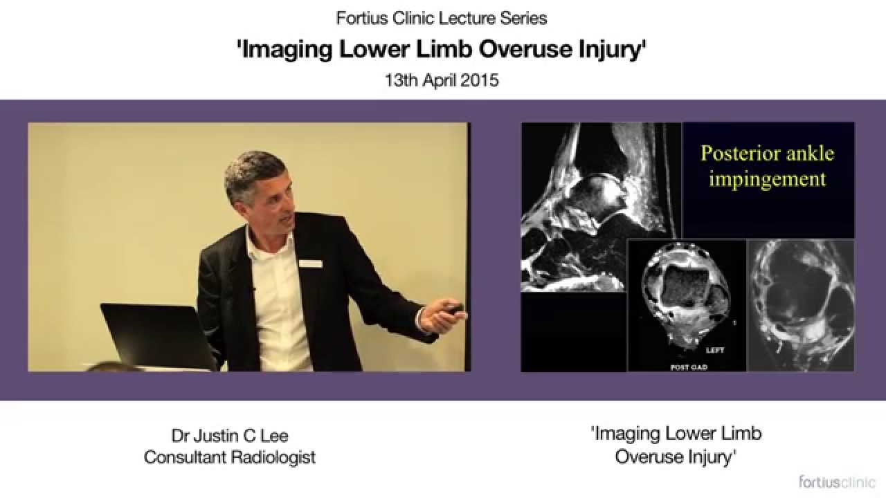 Imaging of overuse injuries