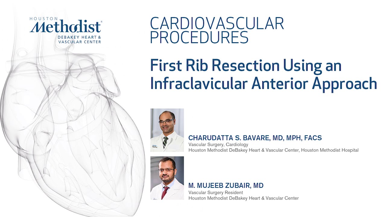 First Rib Resection Using an Infraclavicular Anterior Approach (C