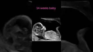 Hello Second Trimester! 14 Weeks In 💕🍼 #baby #pregnancyultrasound #ultrasound #positivebirth