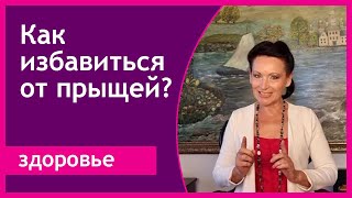 Прыщи на лице и теле. Причины появления и лечения у детей и взрослых. Галина Гроссманн