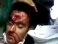 Basij Militia brutaly are beating protesters to death on the streets of Tehran June 23 2009