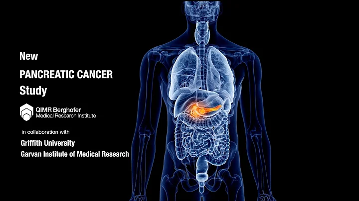 Pancreatic cancer: Can technology deliver a breakthrough?