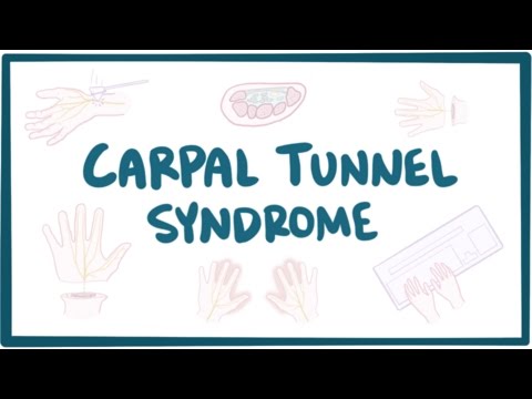 Vidéo: Tunnel Carpien: Causes, Symptômes Et Diagnostic