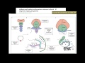 Hind brain embryology through pathology