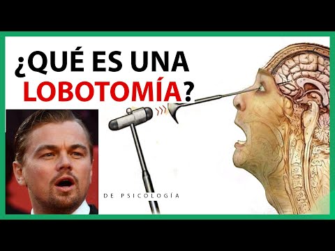 Vídeo: Què és una lobotomia prefrontal?