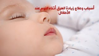 اسباب وعلاج مشكلة زيادة العرق عند الاطفال اثناء النوم