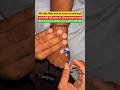 IV Cannulation Shorts video #reels #usa #trending #trendingshorts #viral #youtubeshorts #ivcannula