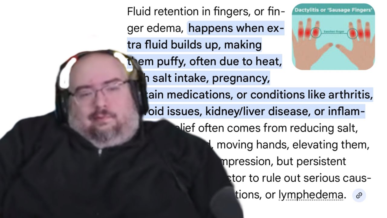 Wings Of Redemption has fluid build up in his fingers | Ai is a fad