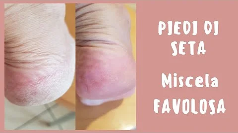 Come pulire i piedi fai da te?