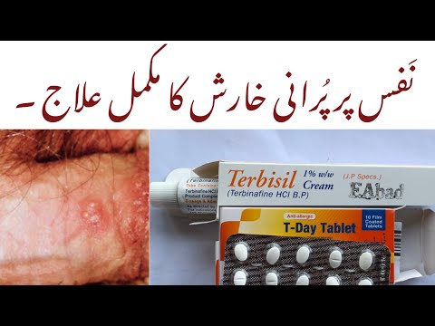 #Nafs par kharish aur danoo ka mukamal ilaj #symptoms and treatment.