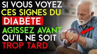 8 signes que le diabète type 2 est en train de s'installer | 3 aliments qui aident à la prévention