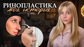 видео: Я мечтала стать красивее, но ринопластика пошла не по плану... картинка: Я мечтала стать красивее, но ринопластика пошла не по плану...