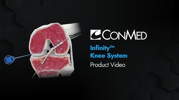 Infinity™ Knee System - CONMED Product Video