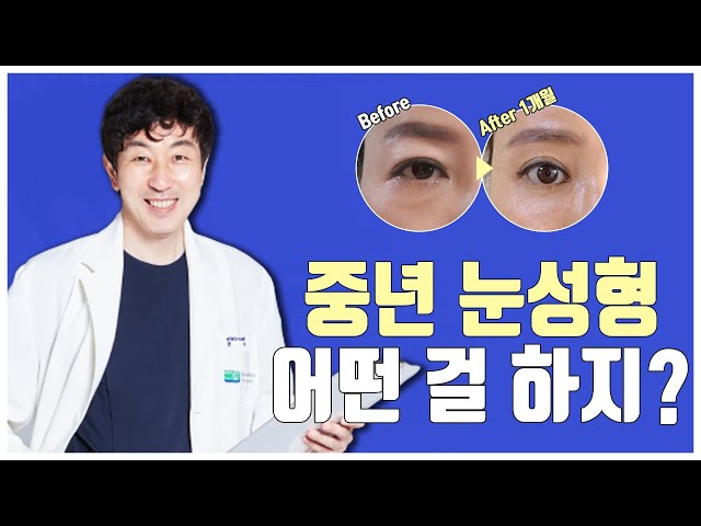 상안검vs눈썹거상술vs내시경이마거상술, 어떤 걸 해야죠?