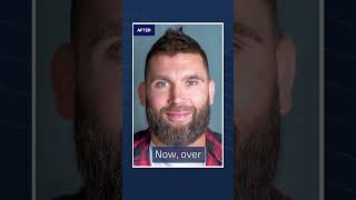 UFC Veteran Jeremy Stephens Shares His Hair Restoration Transformation | Bosley HairClub