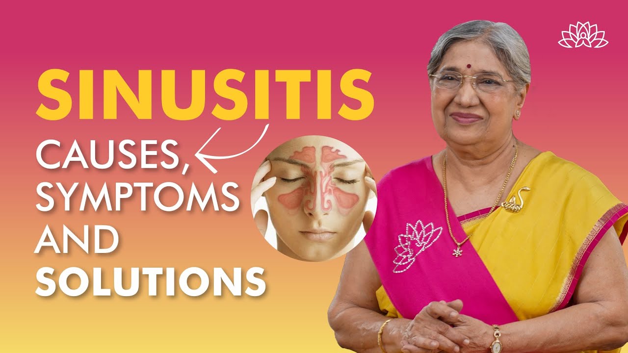 What Is Sinusitis Sinusitis Causes Symptoms Treatment Sinus what-is-sinusitis-sinusitis-causes-symptoms-treatment-sinus