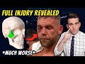 *UPDATE* Billy Joe Saunders Eye Injury DETAILS REVEALED vs Canelo Alvarez - Doctor Explains