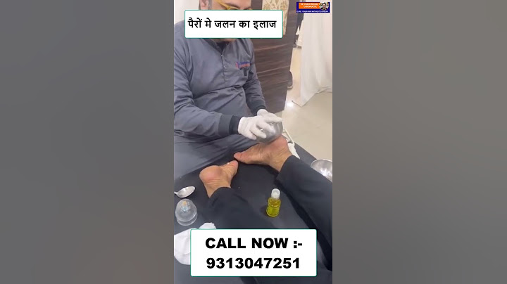 पैरों मे जलन का इलाज | Chiropractic treatment in Delhi, India | Dr. Varun | Call - 9313047251 #delhi