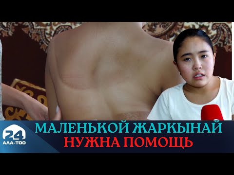 Video: Курт жумурткасынан арылуунун 4 жолу