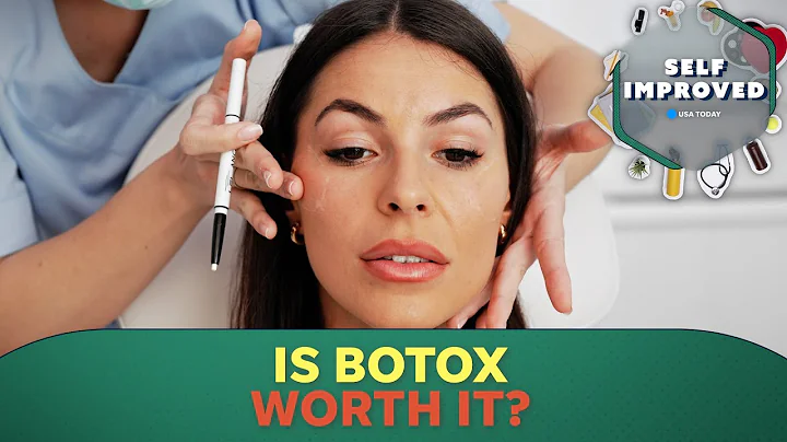 Dermatologist explains how Botox can improve your appearance | SELF IMPROVED