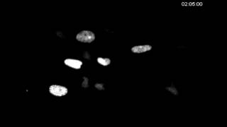 Cell-Based Screen For Altered Nuclear Phenotypes Reveals Senescence Progression In Polyploid...