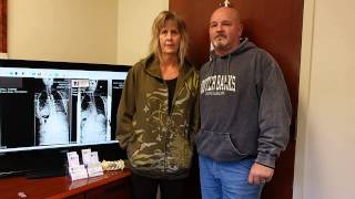 54 Year-old Patient Shares Her Scoliosis Journey