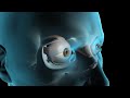 Glaucoma Surgery - YouTube