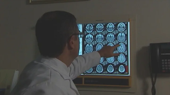 Study: Targeted drug therapy slows progression of certain brain tumors
